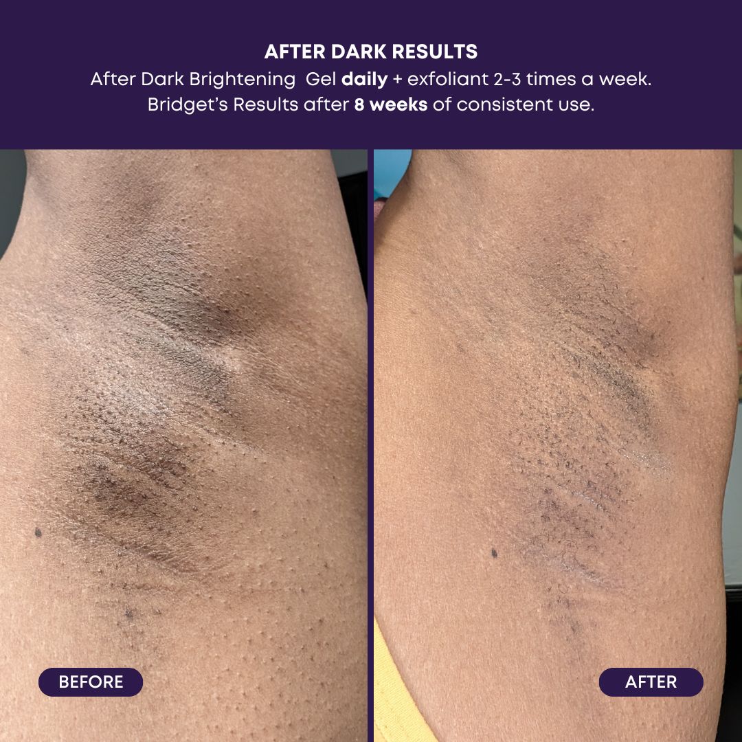 After Dark Brightening Gel - Image 4