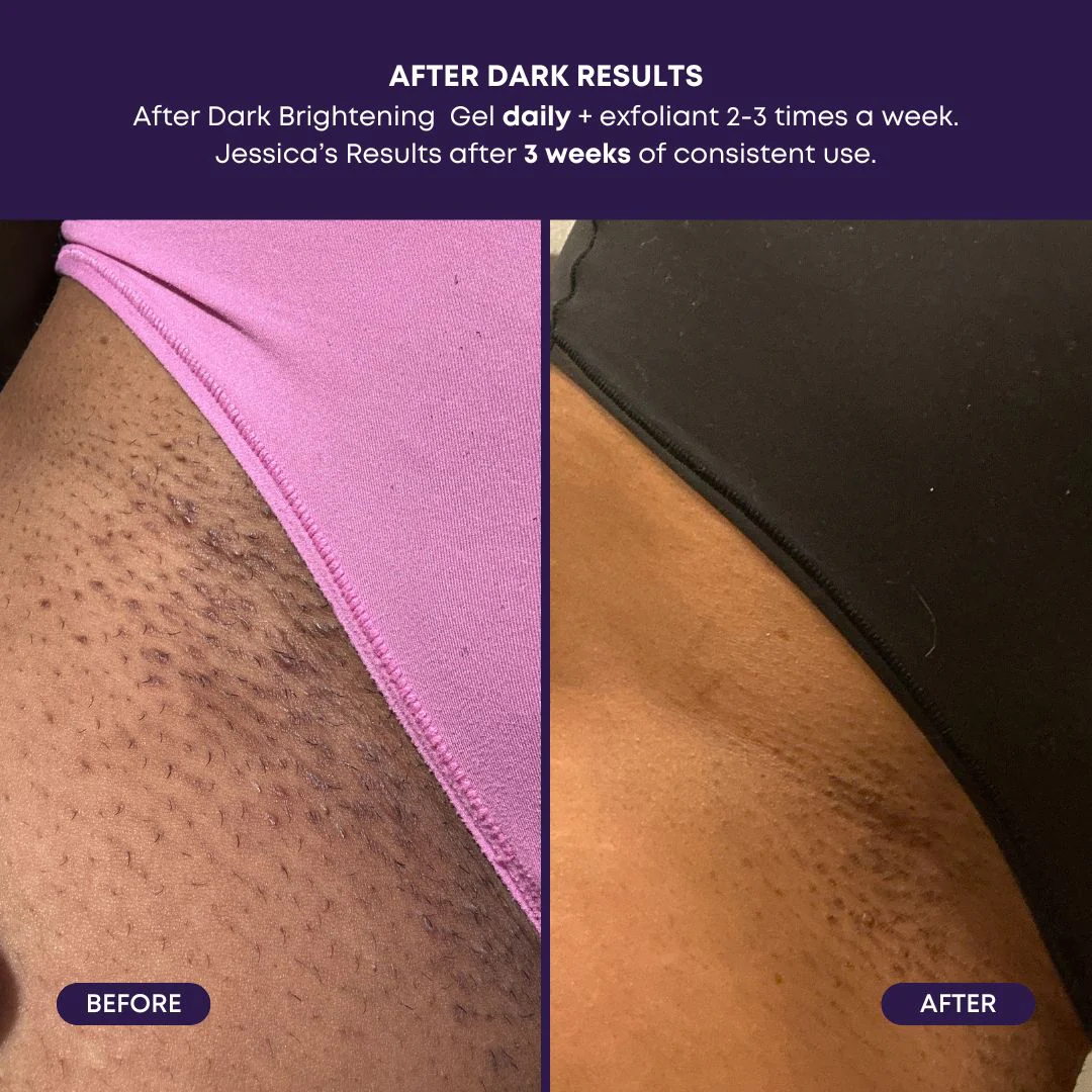 After Dark Brightening Gel - Image 5
