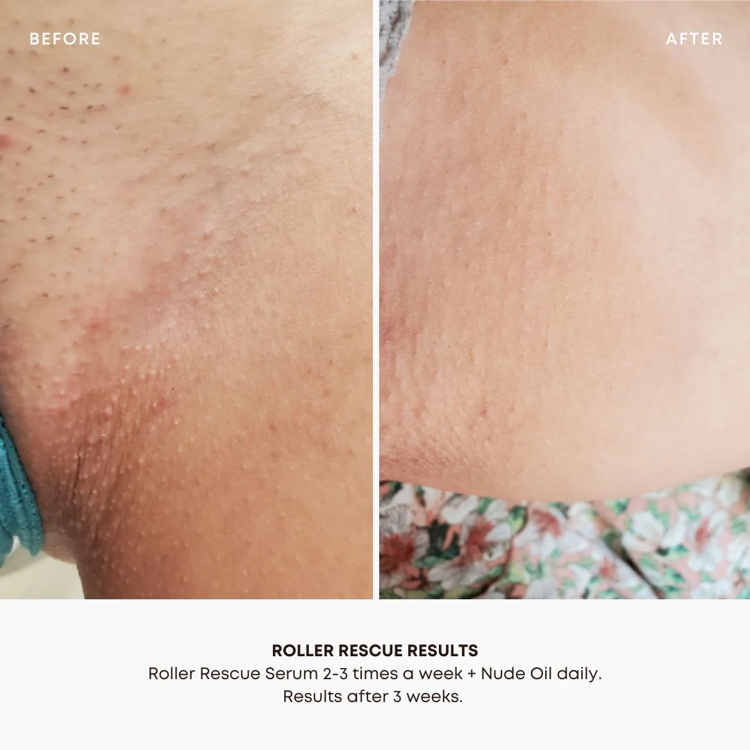Roller Rescue Soothing Serum - Image 3