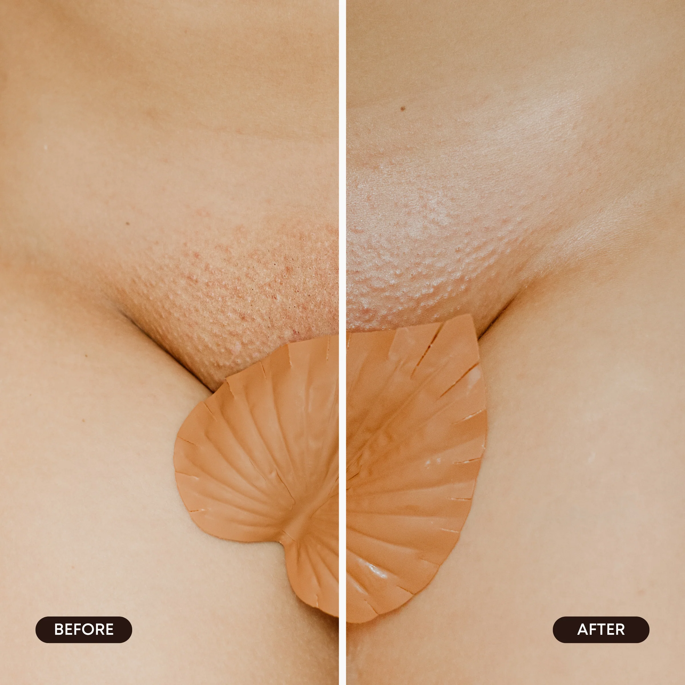 Hydrogel Vajacial Mask Set - Image 5
