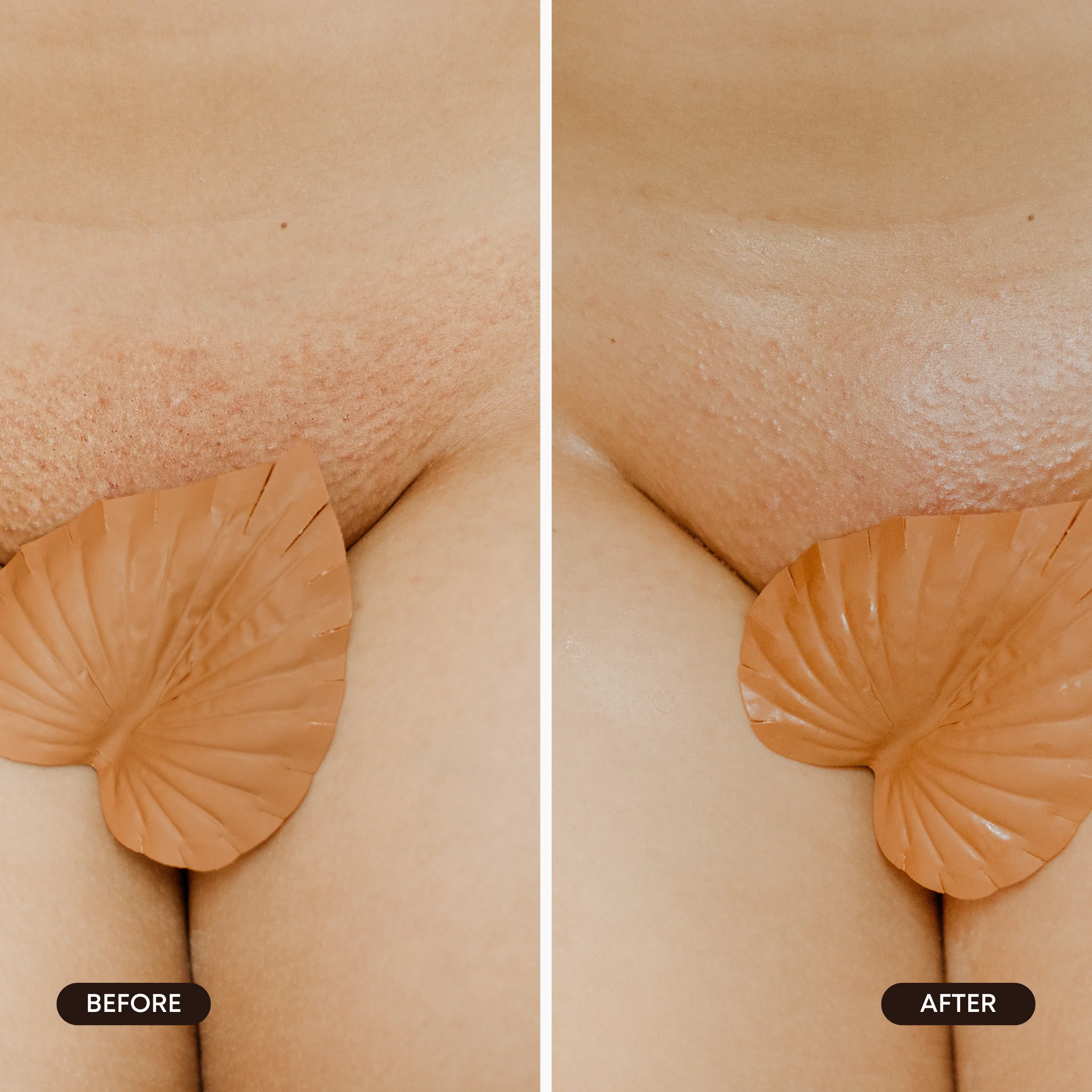 Hydrogel Vajacial Triangle Mask - Backbar - Image 6