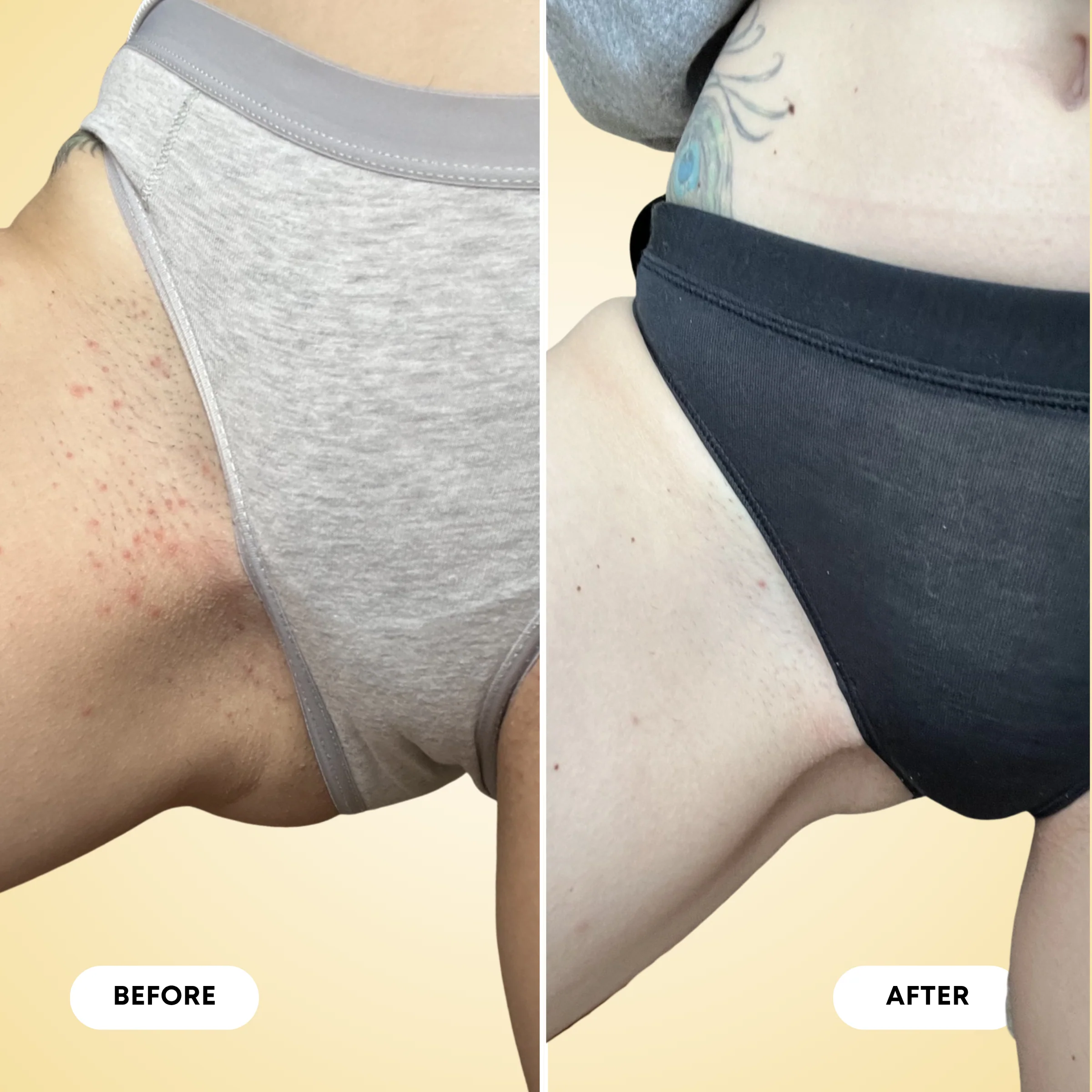 Ingrown Hair Exfoliating Body Scrub - Image 7