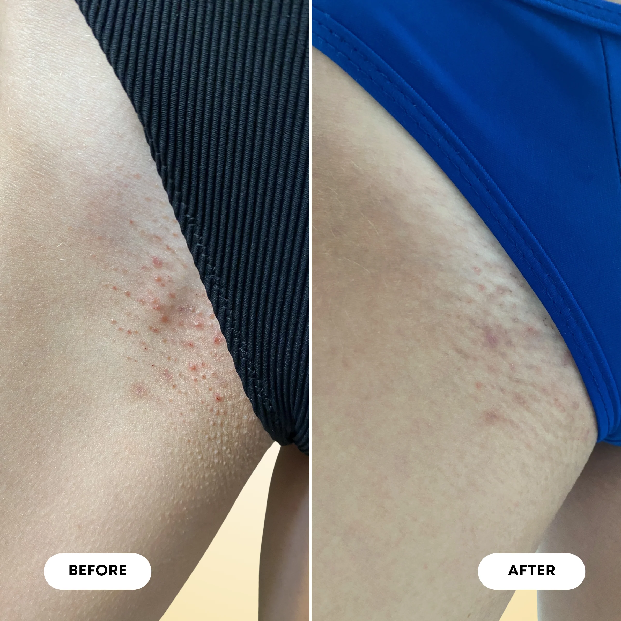 Ingrown Hair Oil & Scrub Bundle - Image 7