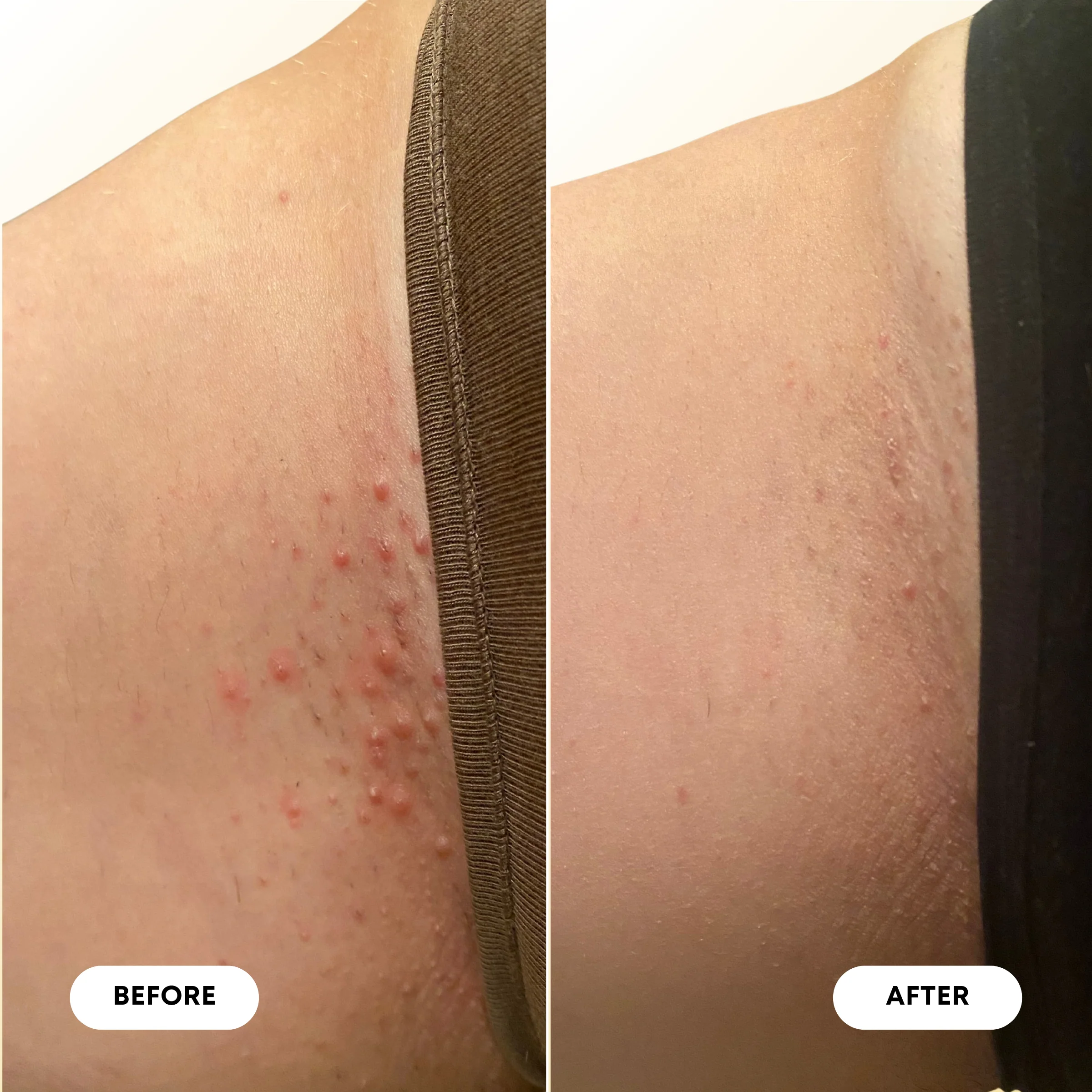 Ingrown Hair & Pre-Post Wax Oil - Image 7
