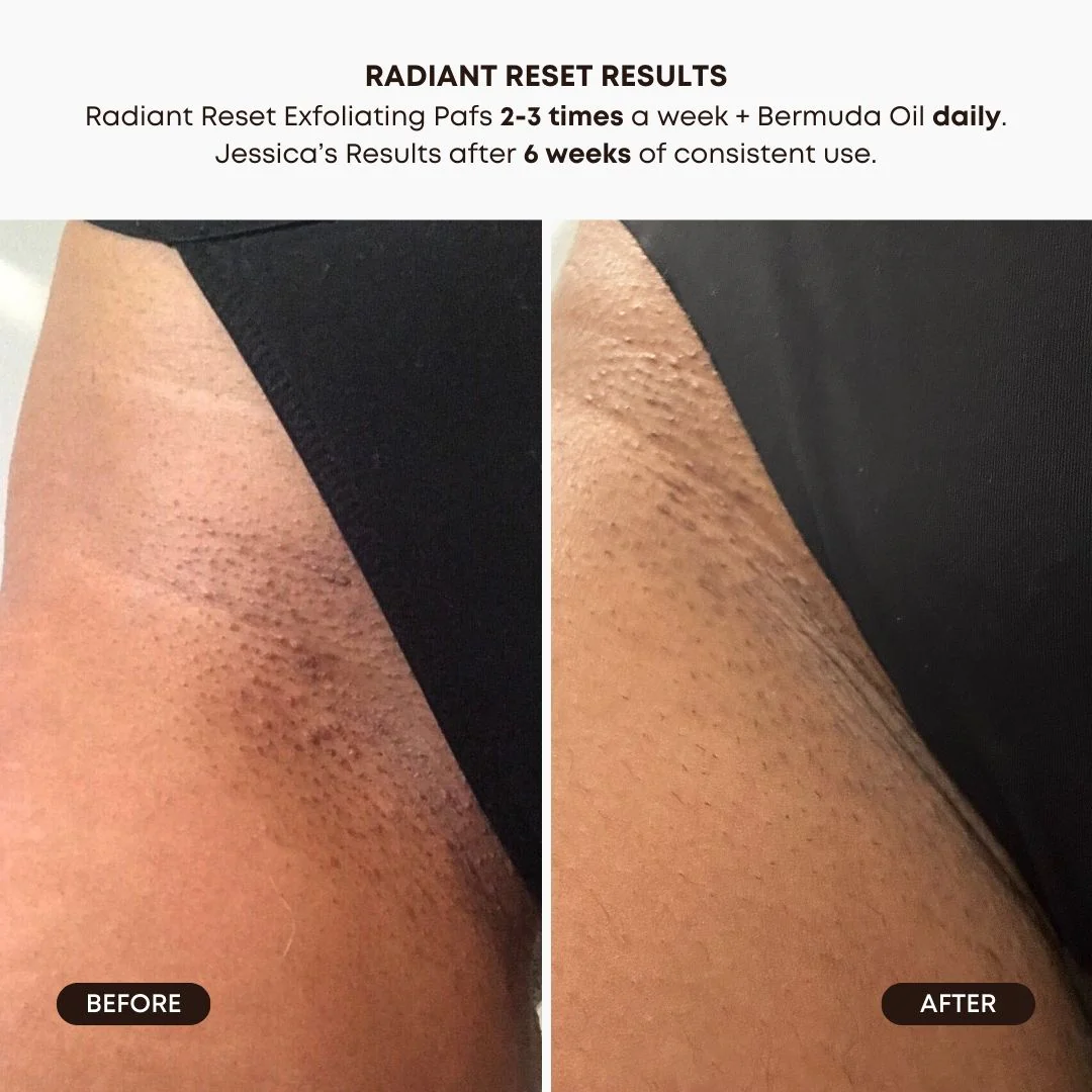 Radiant Reset Exfoliating Toner Pads - Image 4