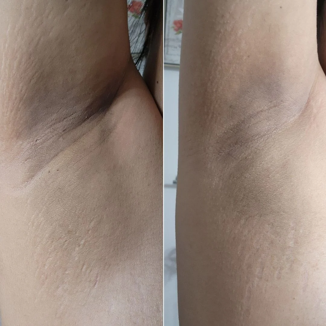 Radiant Reset Exfoliating Toner Pads - Image 9