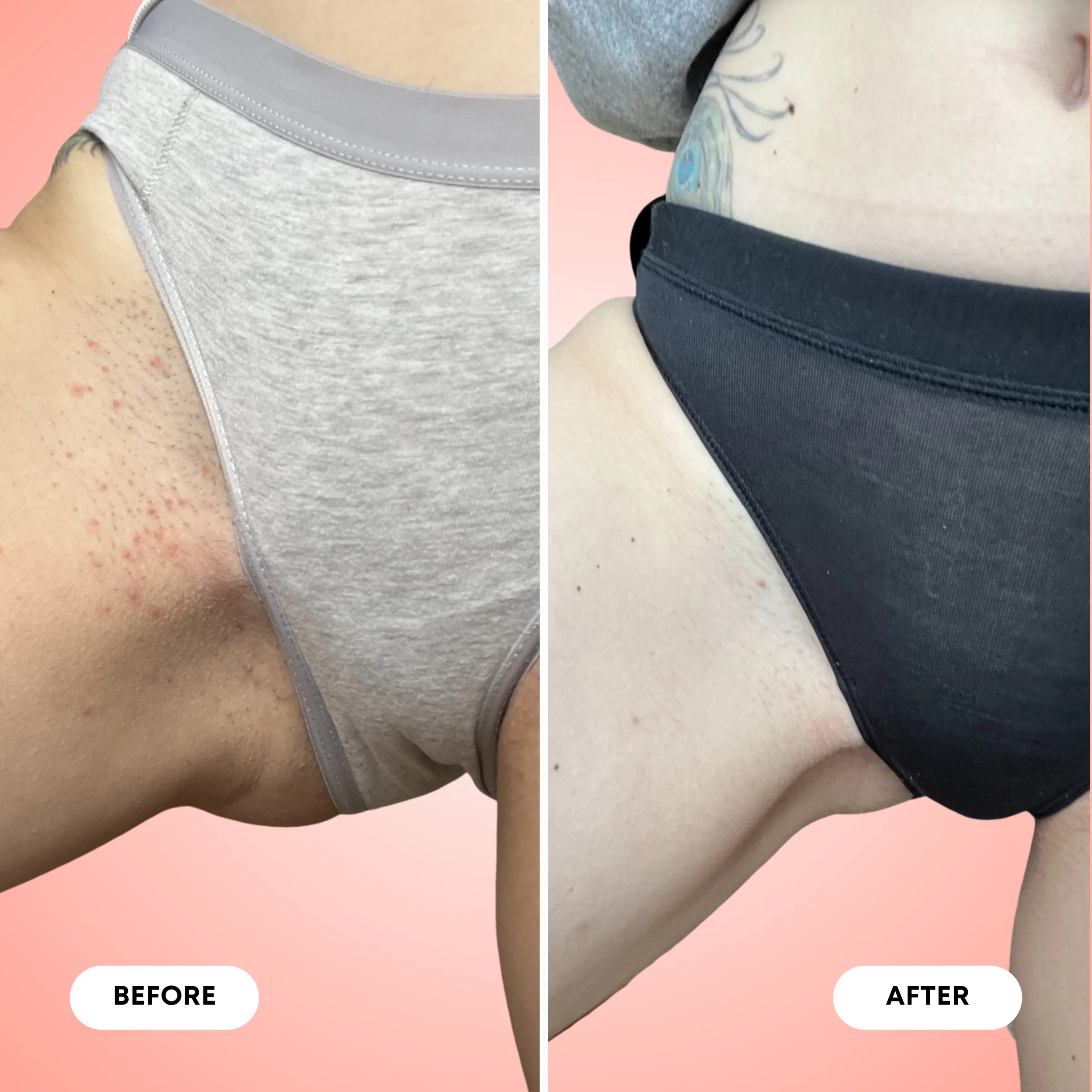 Ingrown Hair Exfoliating Body Scrub - Image 7