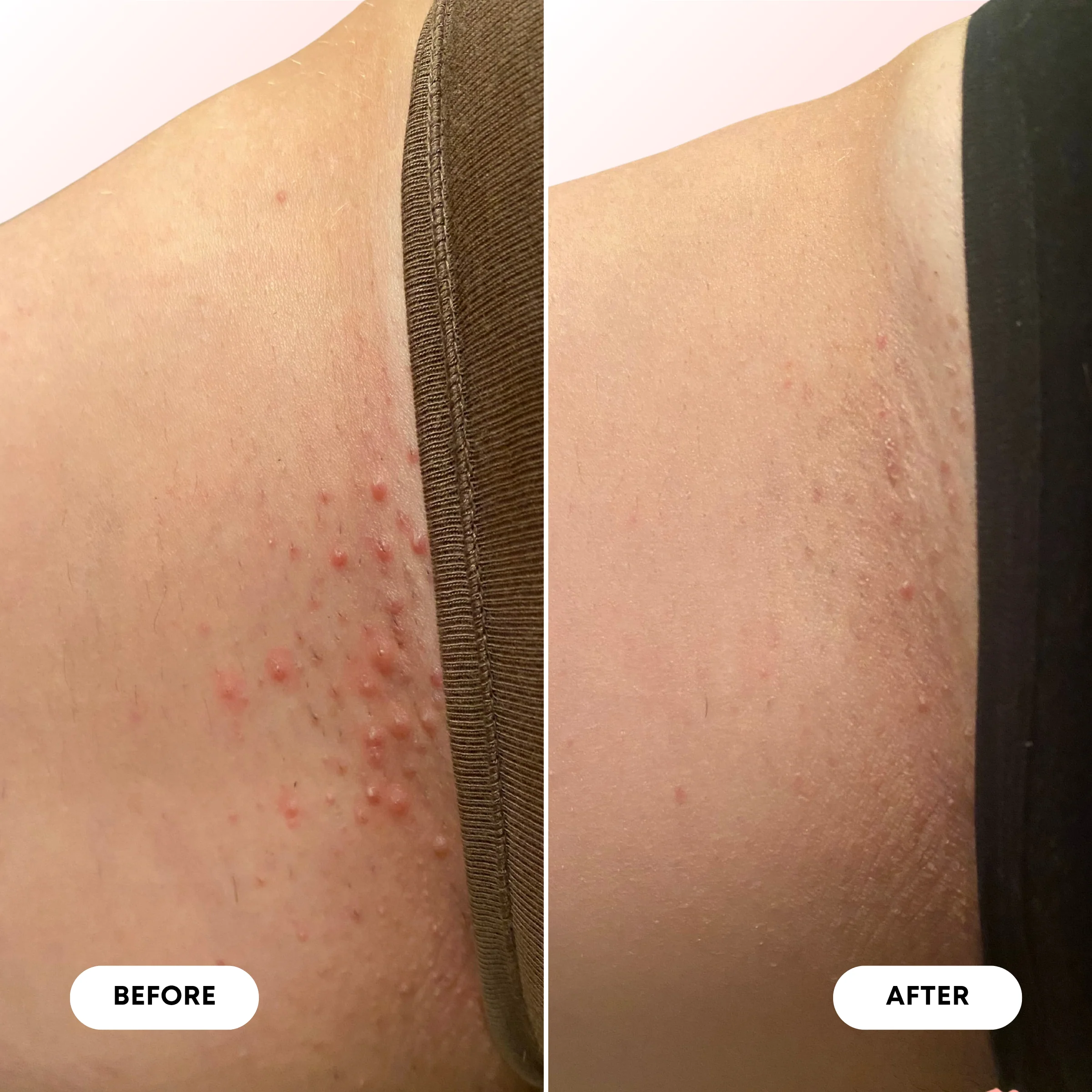 Ingrown Hair Pre/Post-Wax Oil - Image 7