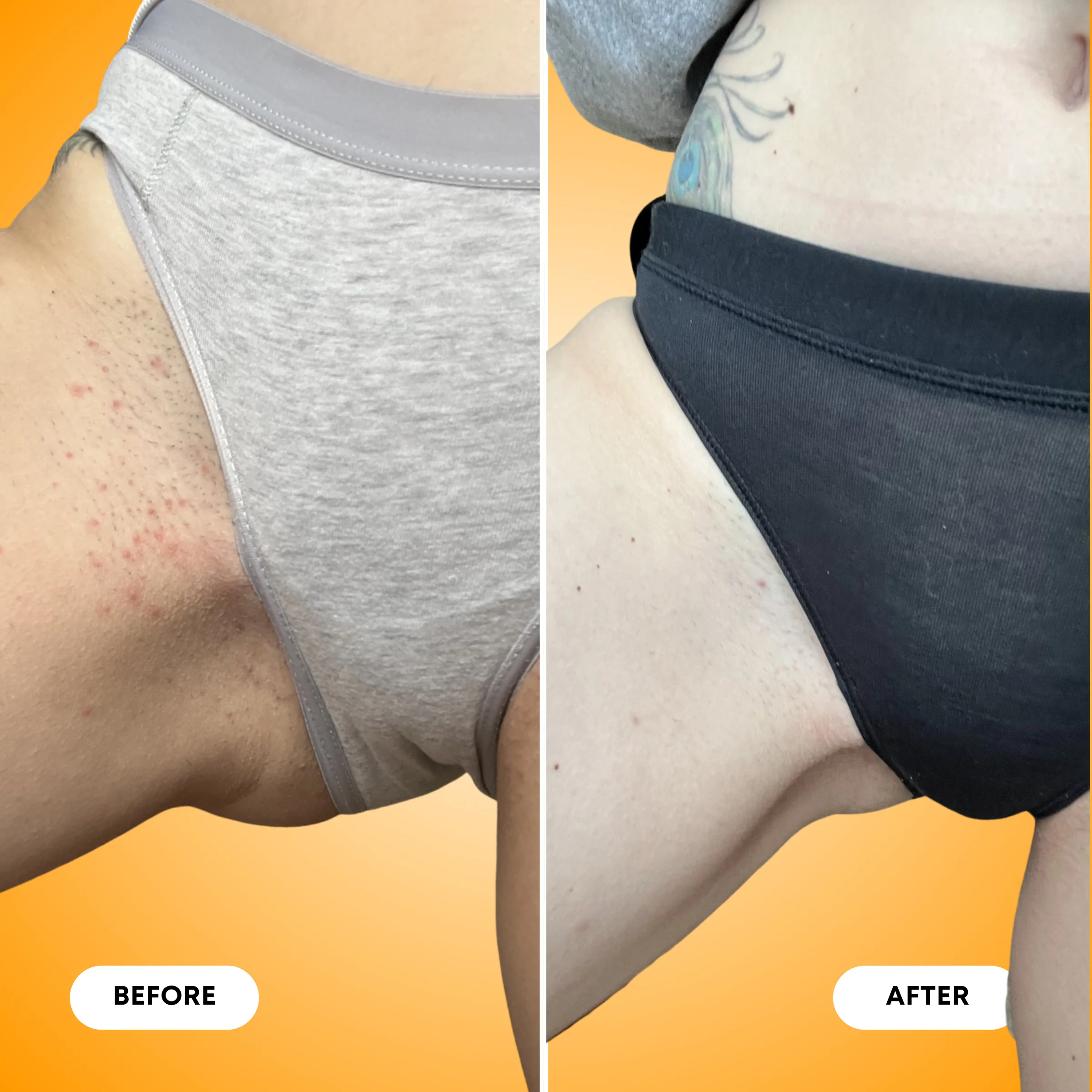 Ingrown Hair Exfoliating Body Scrub - Image 8