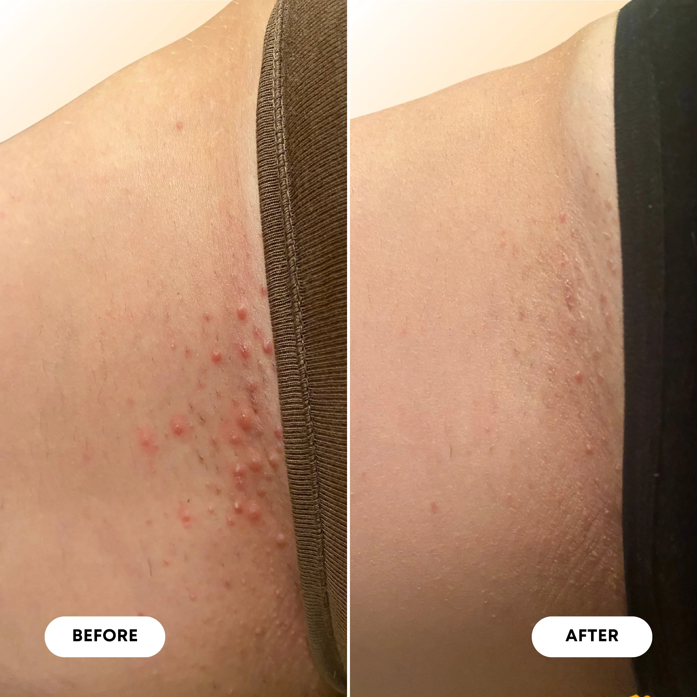 Ingrown Hair & Pre-Post Wax Oil - Image 8